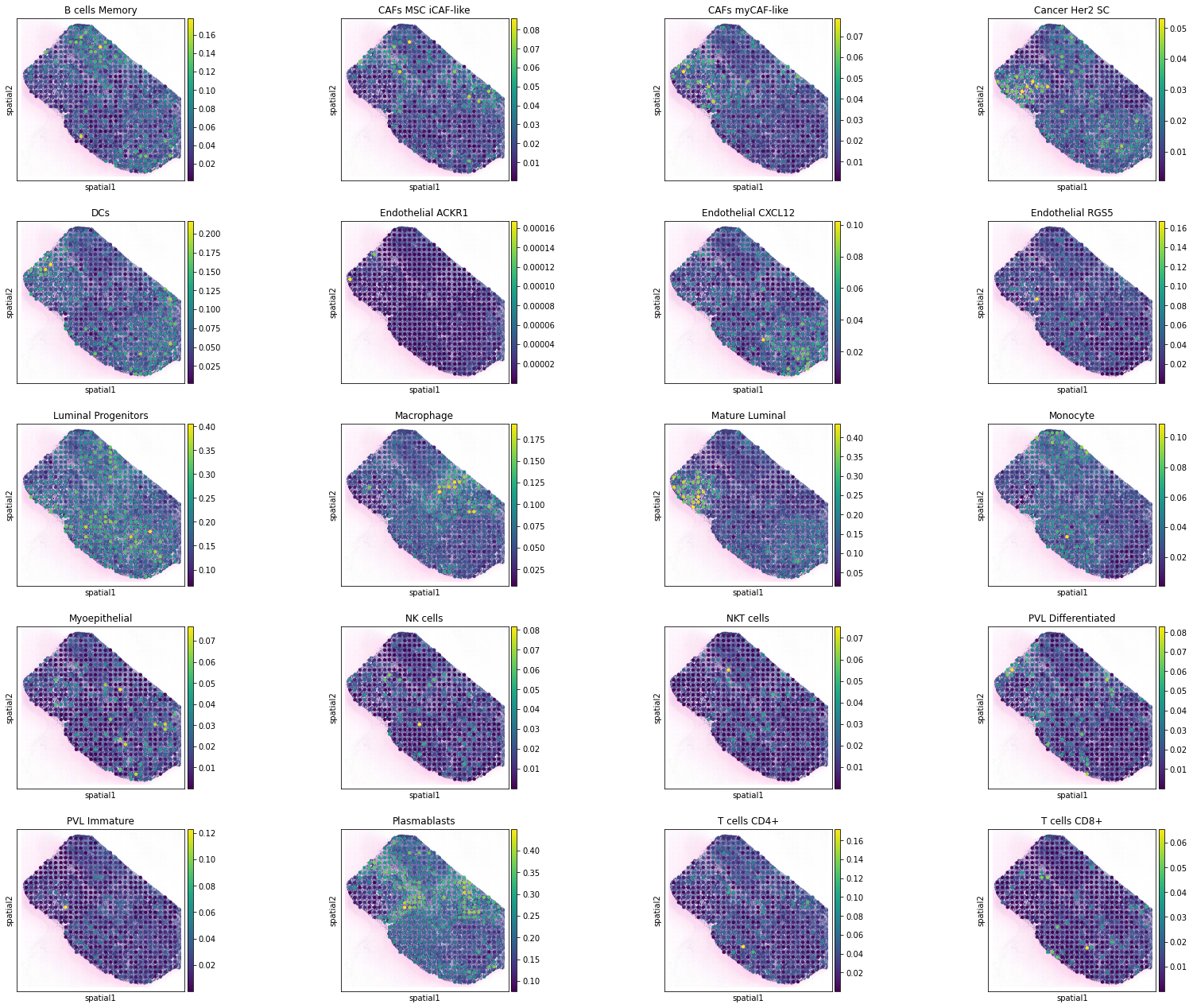 ../../_images/tutorials_breast_cancer_STitch3D_breast_cancer_19_5.png
