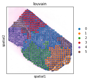 ../../_images/tutorials_breast_cancer_STitch3D_breast_cancer_clustering_and_downstream_5_1.png