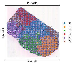 ../../_images/tutorials_breast_cancer_STitch3D_breast_cancer_clustering_and_downstream_5_3.png