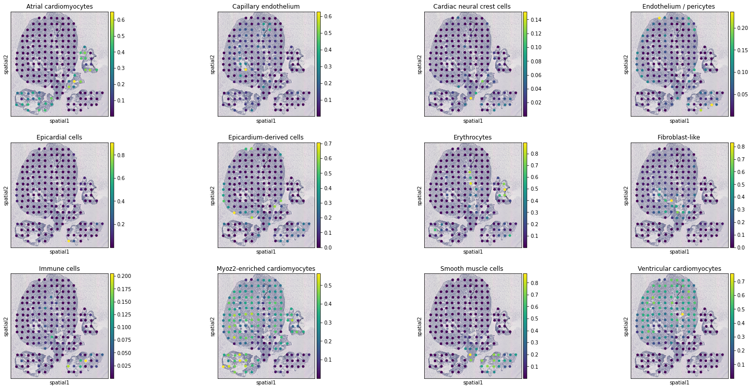 ../../_images/tutorials_human_heart_STitch3D_human_heart_19_13.png