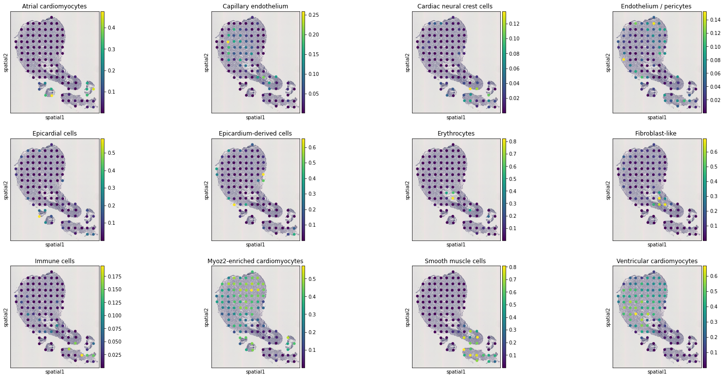 ../../_images/tutorials_human_heart_STitch3D_human_heart_19_3.png