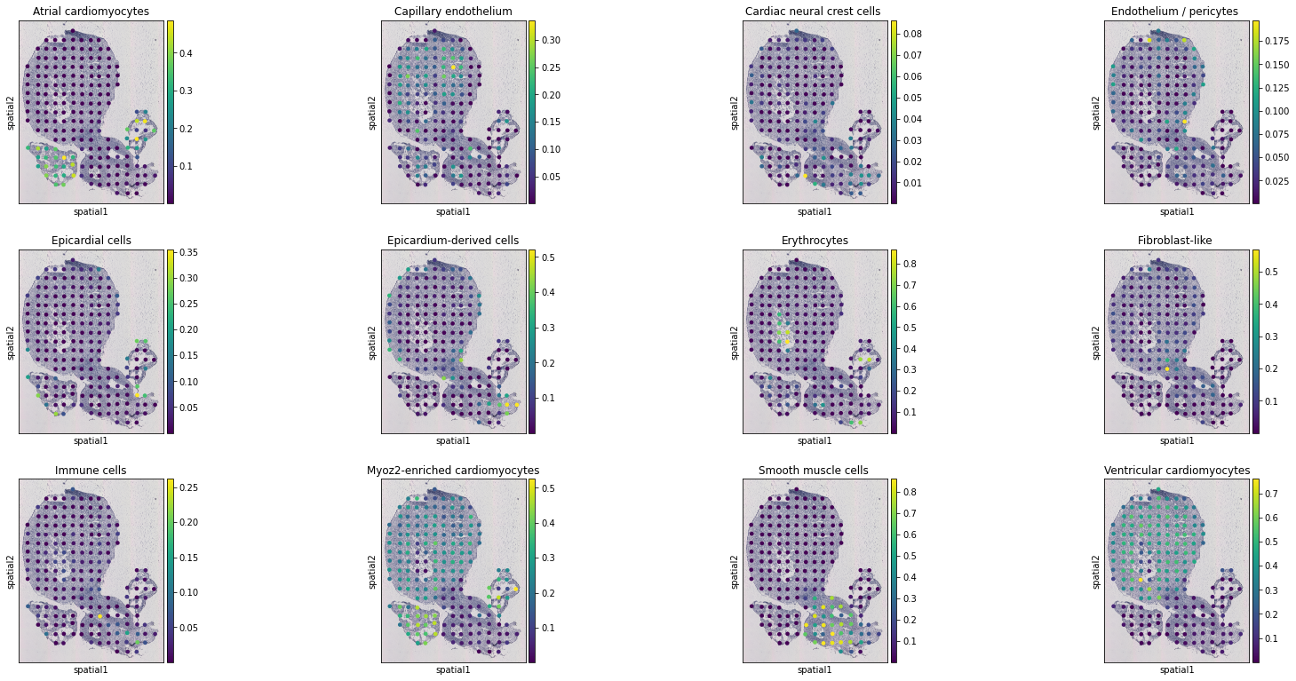 ../../_images/tutorials_human_heart_STitch3D_human_heart_19_7.png